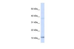 NHLH1 Antibody, Novus Biologicals 100 &mu;L | Buy Online | Novus Biologicals | Fisher Scientific